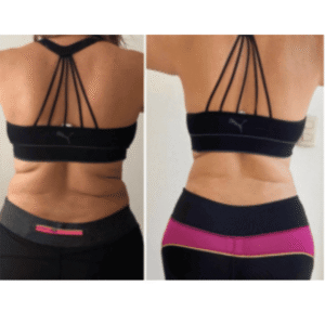 Antes y después de programa online de nutrición de perdida de peso y balance hormonal